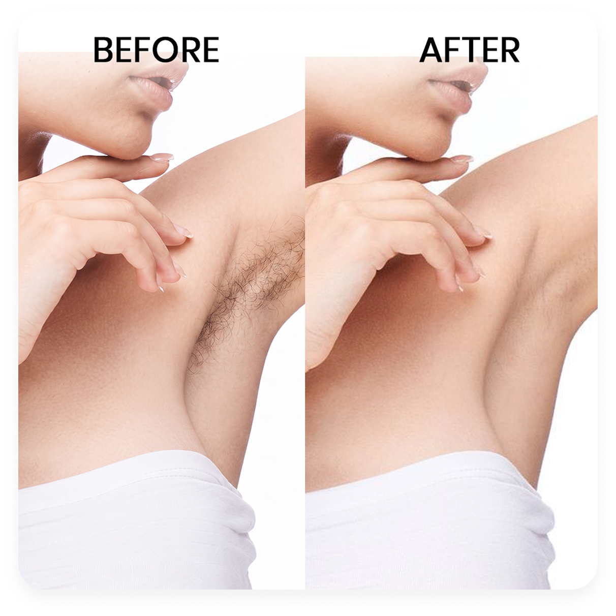 NATURA Natural Hair Inhibitor