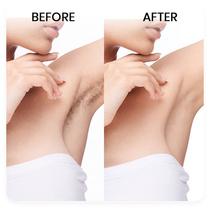NATURA Natural Hair Inhibitor